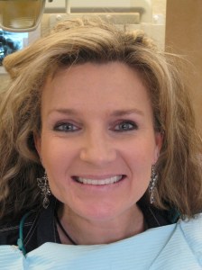 Woman after improving her smile with new teeth