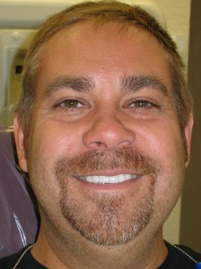 Man after dental treatment